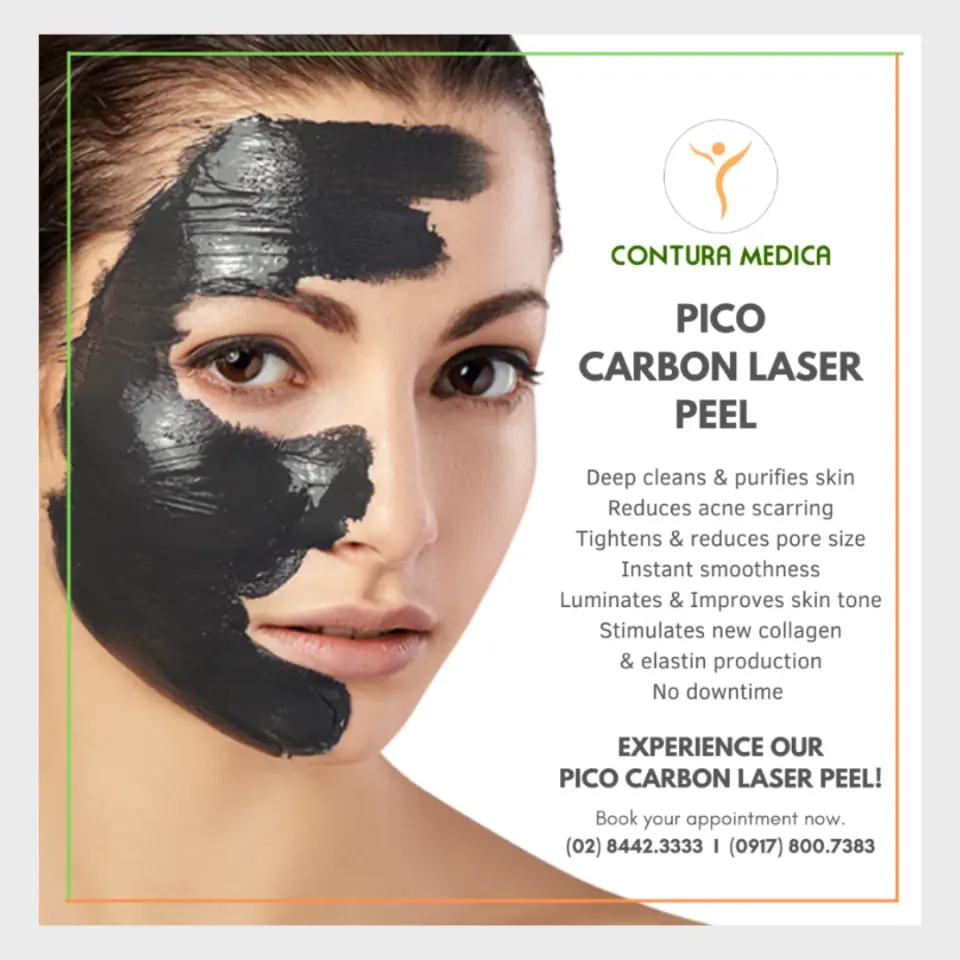 Promotional graphic for a carbon laser peel: a woman with a black mask on half her face beside a list of benefits and booking details.
